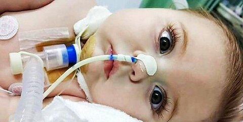 درمان رایگان کودکان مبتلا به هافمن در دولت سیزدهم محقق شد