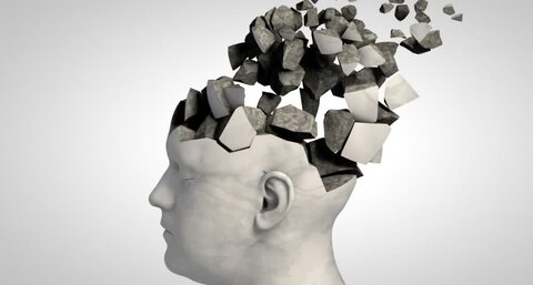 یک روش جدید و غیر تهاجمی برای تشخیص آلزایمر